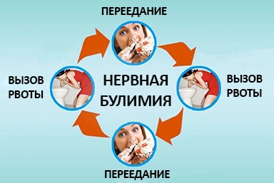 Лечение булимии в Полтаве